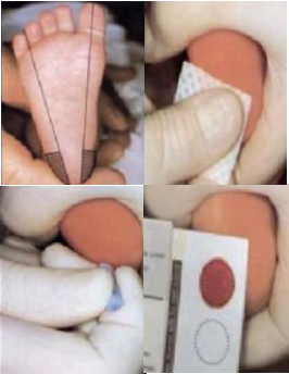 新生兒采血卡.jpg 新生兒采血卡.jpg